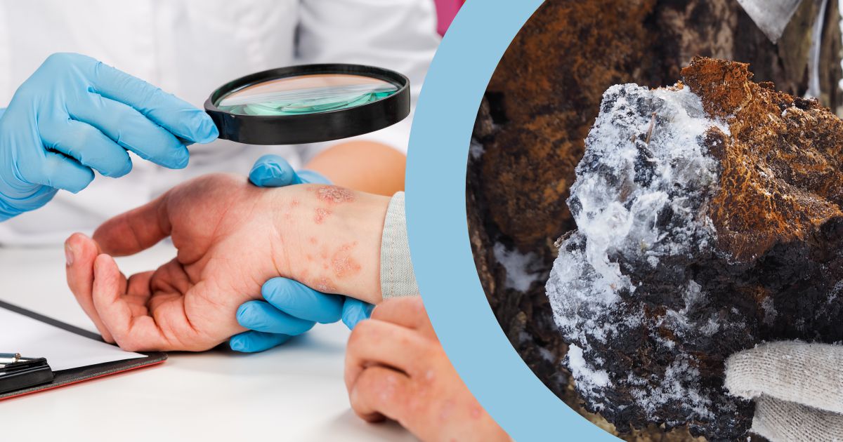 Chaga a Psoriáza